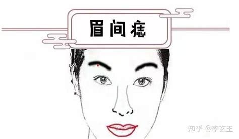 下巴有痣女|女性面相痣详解